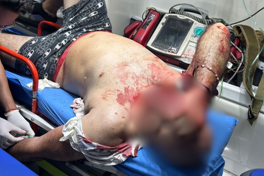 Man killed after fight outside San Miguel bar: four bouncers detained