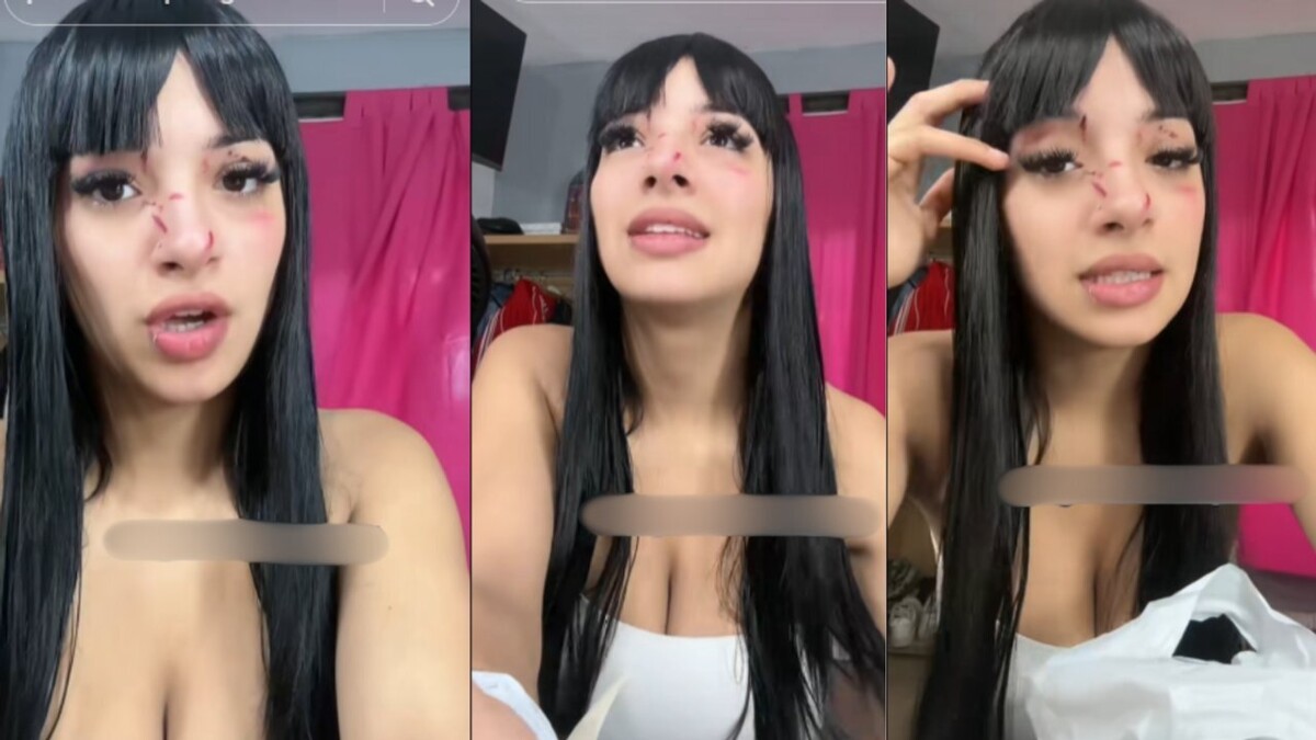 18-летнюю девушку жестоко избили после спора о TikTok
