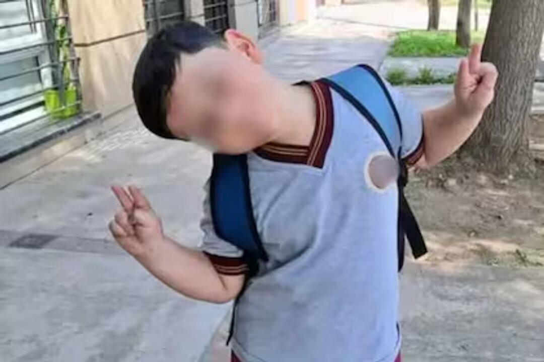 8-летний мальчик в Пинамаре перенес шестую операцию после аварии