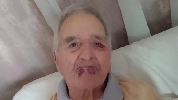 89-Year-Old Man Brutally Assaulted by Nurses in Mar del Plata Nursing Home
