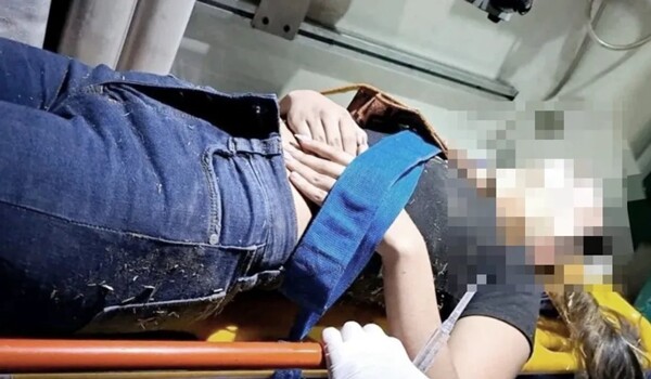 Подросток с аутизмом подверглась жестокому нападению в Аргентине