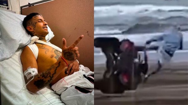 L-Gante's Accident in Pinamar: Collarbone Fracture