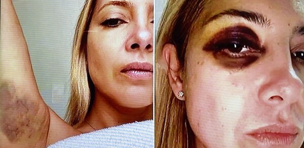 Бывшая первая леди Аргентины подтвердила факты физического насилия