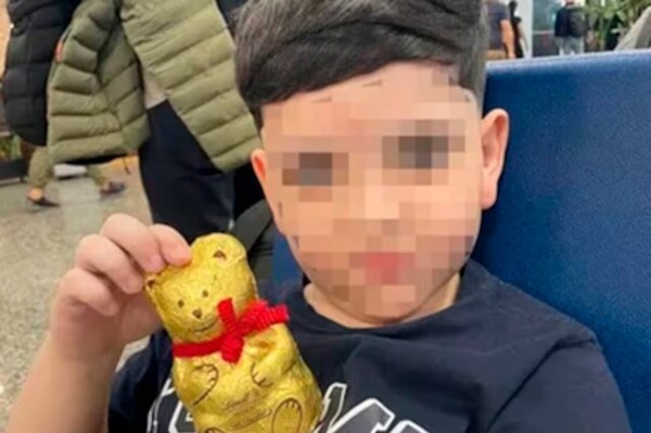 8-летний аргентинский ребенок получил серьезные травмы в результате несчастного случая