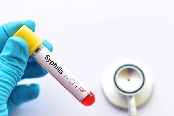 Сифилис в Аргентине достиг пятилетнего максимума