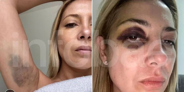 Альберто Фернандес сталкивается с обвинениями в домашнем насилии