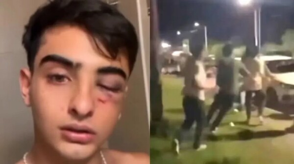 Суд в Аргентине санкционировал арест подозреваемых в жестоком избиении